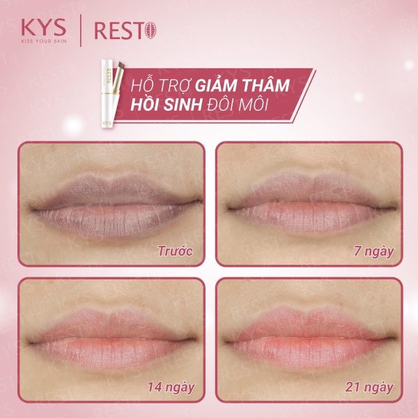 Son dưỡng môi trị thâm giúp hồng Môi RESTO – Chocolate Lip Treatment